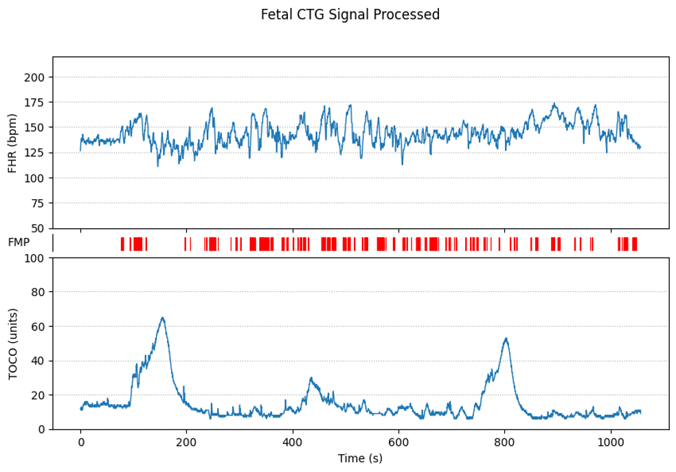 Building a Data Integration Pipeline and Application for Pregnancy Data